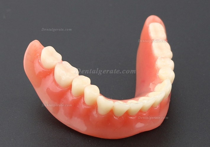 Modell f&uuml;r zahn&auml;rztliche Oberz&auml;hne Overdenture Superior 4 Implantate Demo Modell 6001 02